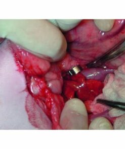 Ameroid Constrictors