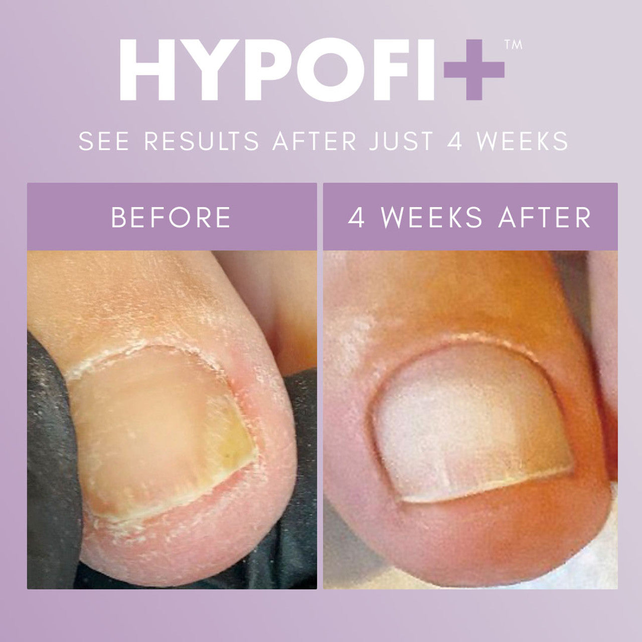 HypoFix Repair Serum 20ML - Image 2